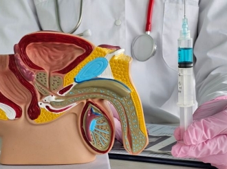 What to Consider for Peyronie’s Disease Treatment